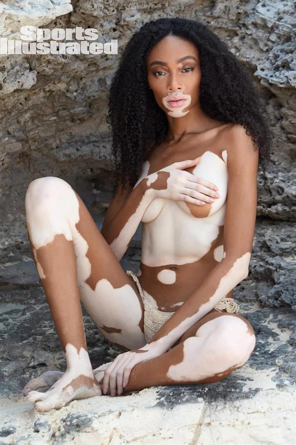 Winnie Harlow - Sports Illustrated Swimsuit Issue 2019: Great Exuma