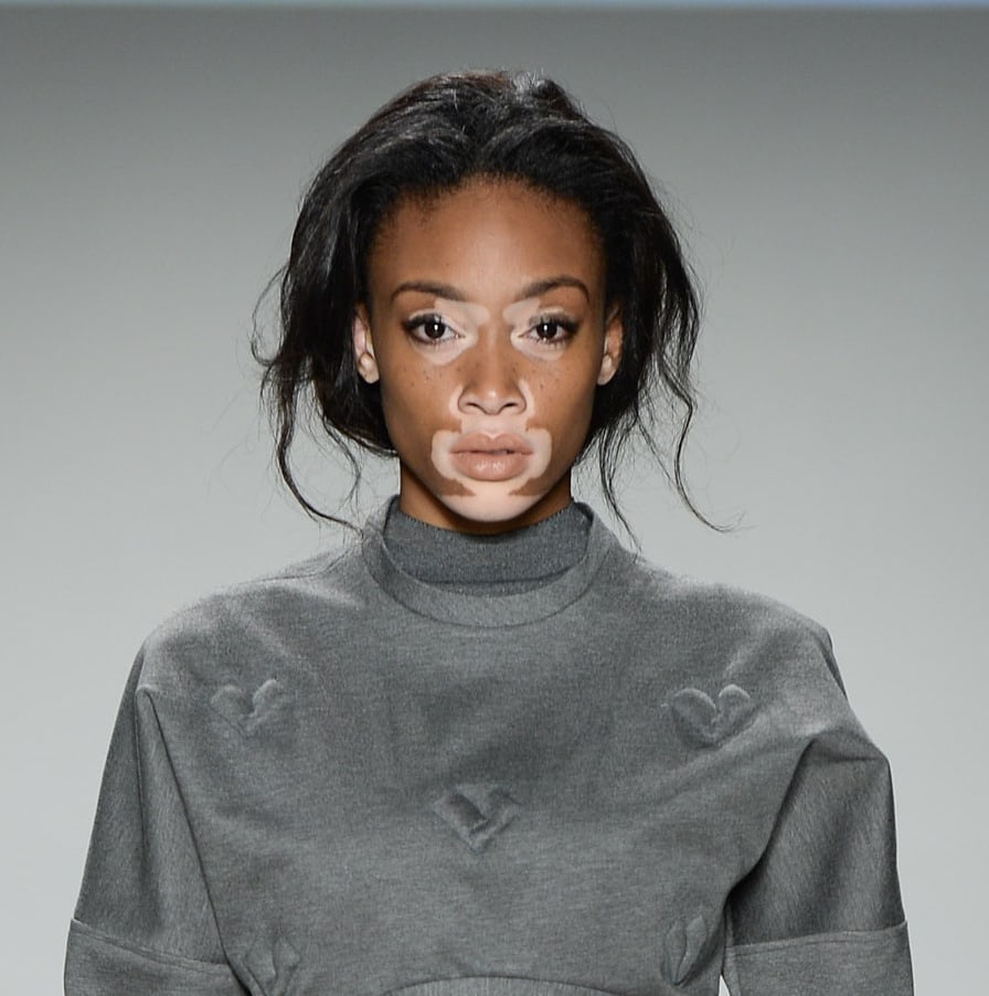 Winnie Harlow