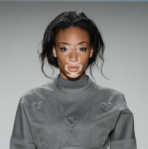 Winnie Harlow