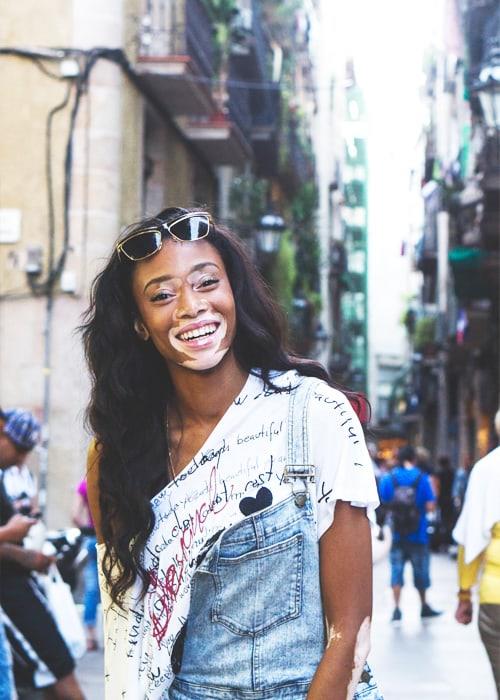 Winnie Harlow