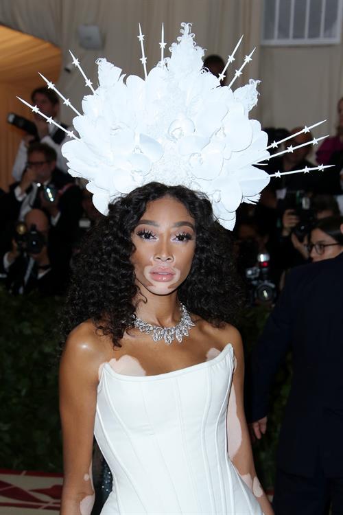 Winnie Harlow