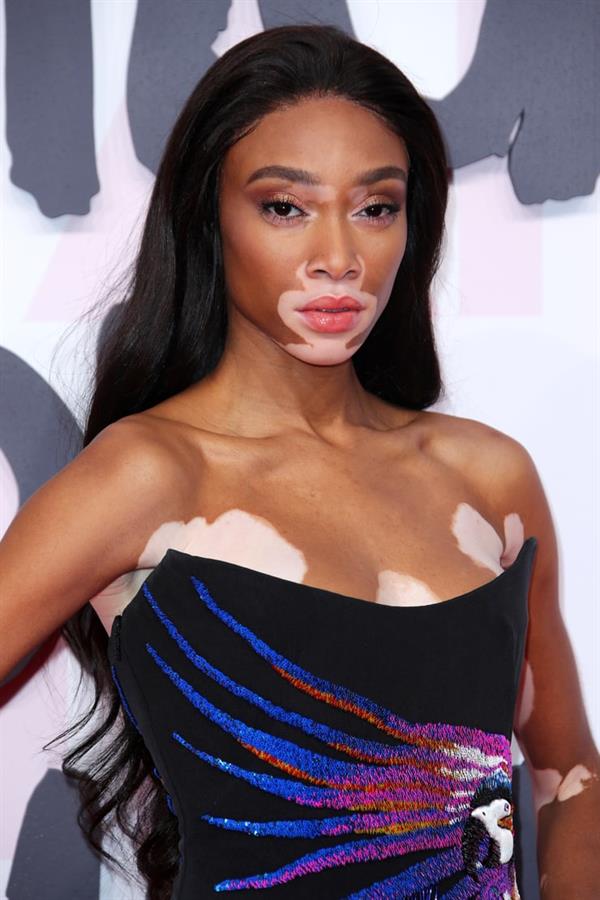 Winnie Harlow