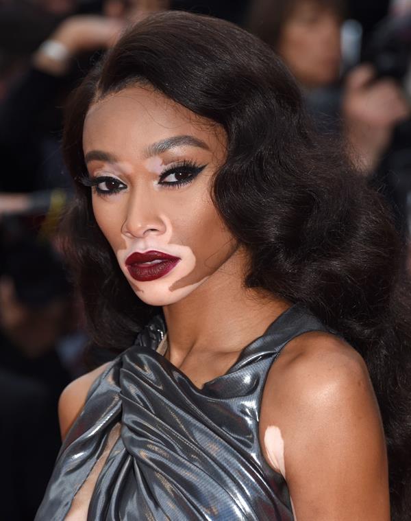 Winnie Harlow