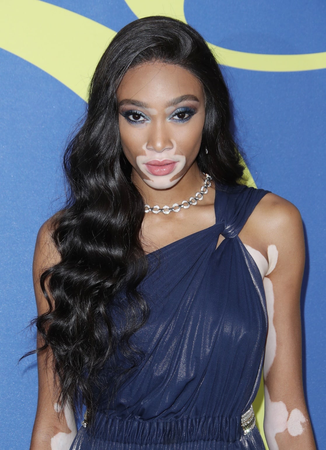 Winnie Harlow
