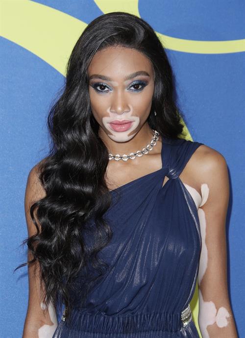 Winnie Harlow