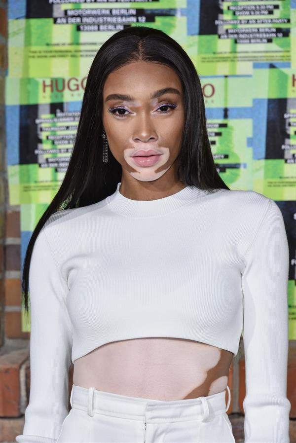 Winnie Harlow