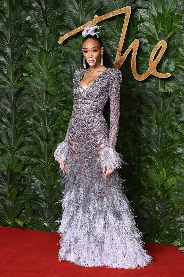 Winnie Harlow