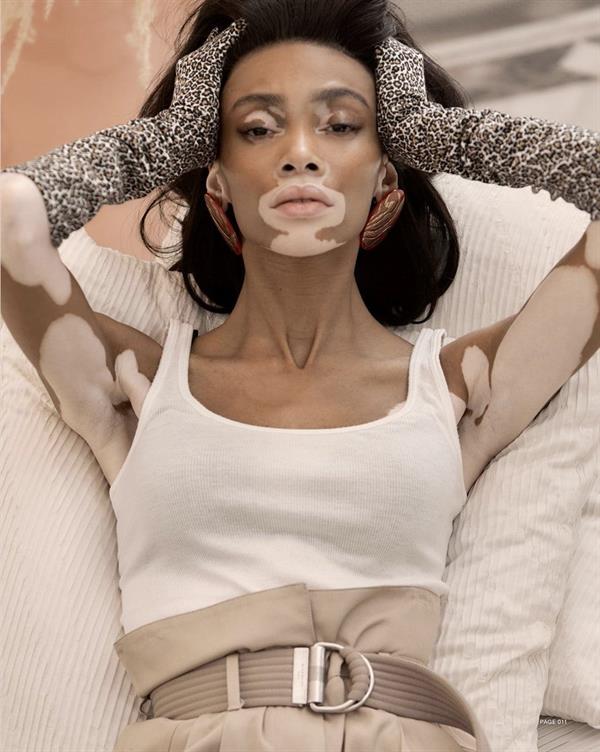 Winnie Harlow