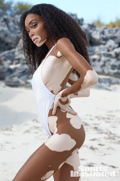 Winnie Harlow in a bikini